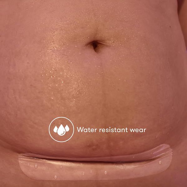 C-Section Silicone Scar Patches (Flexible, Transparent + Waterproof)